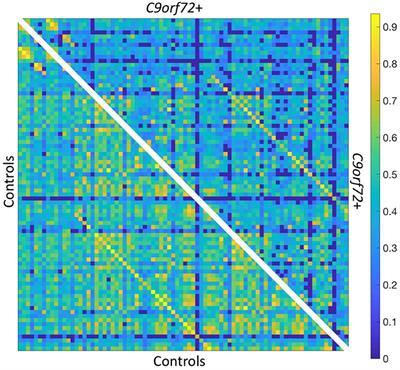 Resting State Functional Connectivity Is Decreased Globally Across the C9orf72 Mutation Spectrum